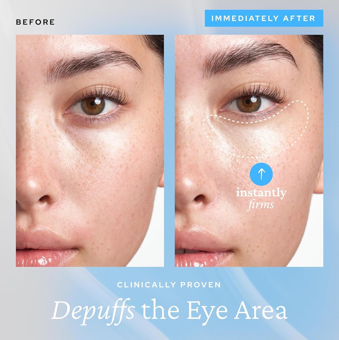 PuffAway Cooling Eye Gel