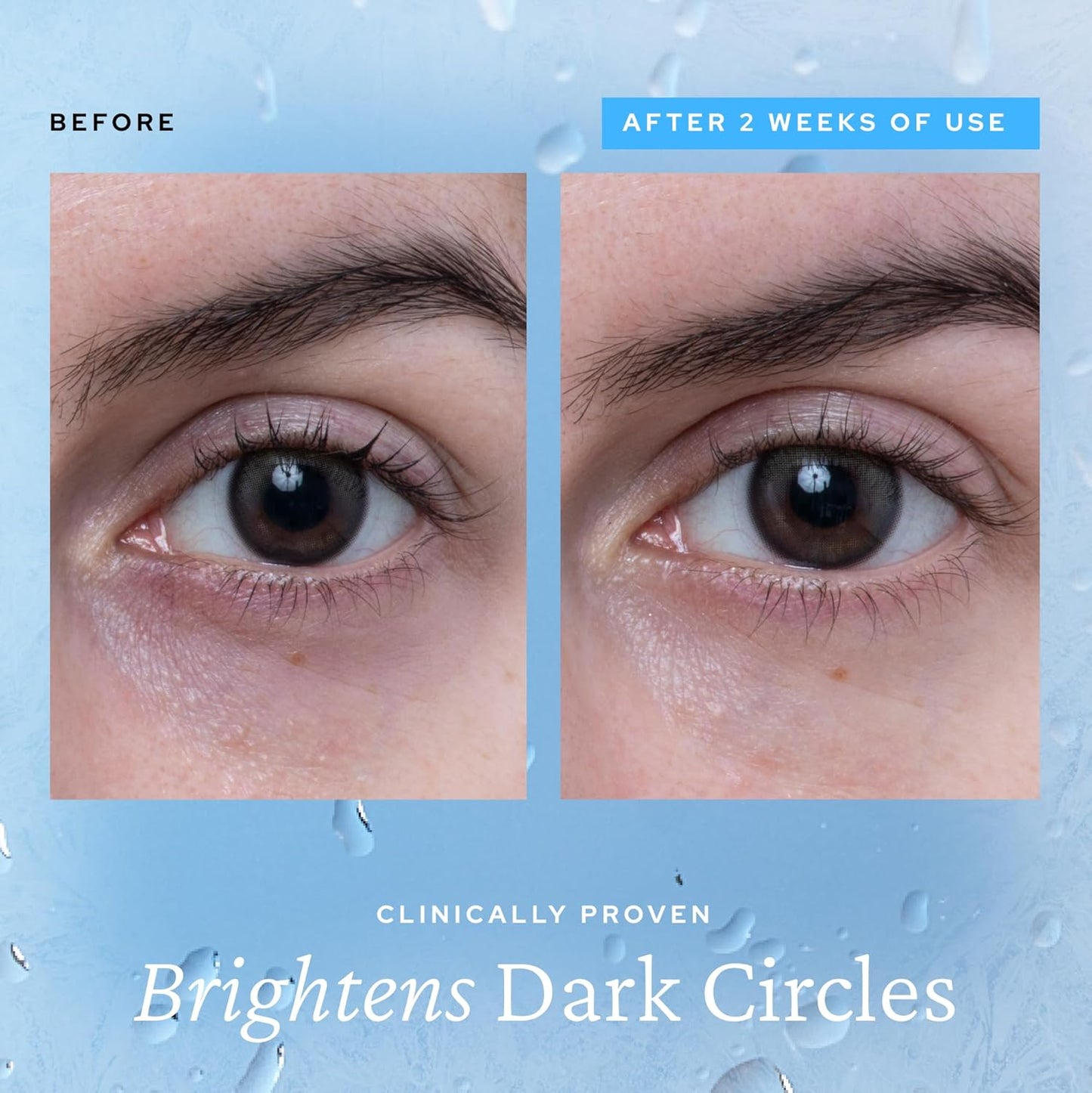 PuffAway Cooling Eye Gel