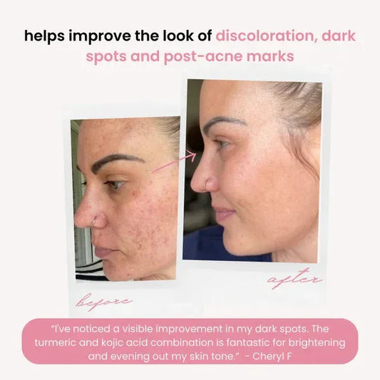 Brightening Turmeric & Kojic Acid Pads